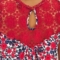 تاپ دانتل طرحدار